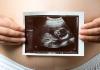 Σύνδρομο εμβρυϊκής μετάγγισης: αιτίες, σημεία, θεραπεία